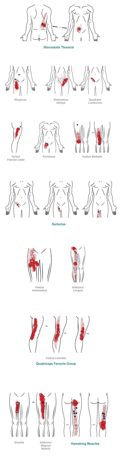 pain relief: trigger point referral pain pattern for the groin ...