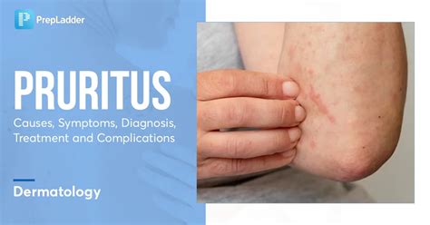 Pruritus: Causes, Symptoms, Diagnosis, Treatment and Complications