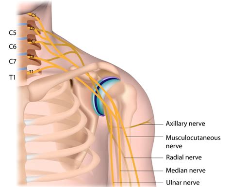 Cervical Rib and Thoracic Outlet Syndrome - Sport Doctor London