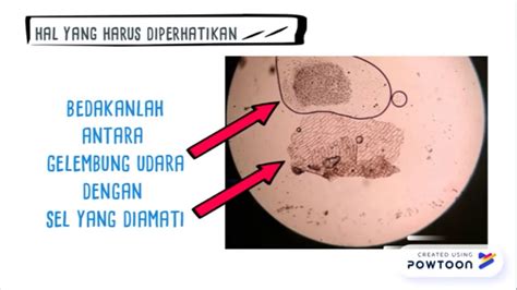 Laporan Praktikum Pengamatan Sel Hewan Dan Tumbuhan Menggunakan ...