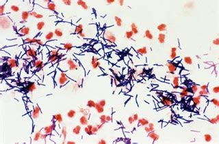 Microbiology: Lactobacillus