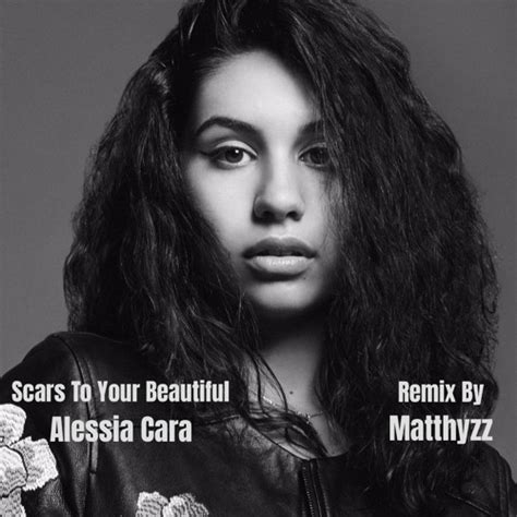 Alessia Cara - Scars To Your Beautiful (Matthyzz Remix) by Matthyzz ...