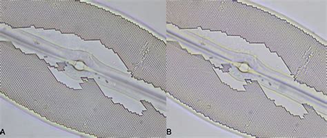 Praise for the humble Achromat | Microscopy of Nature