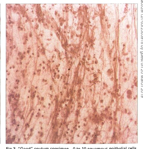 Interpreting the Sputum Gram Stain Report | Semantic Scholar