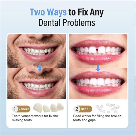 Fake Teeth Repair Kit - Moldable False Tooth for Fixing Broken ...