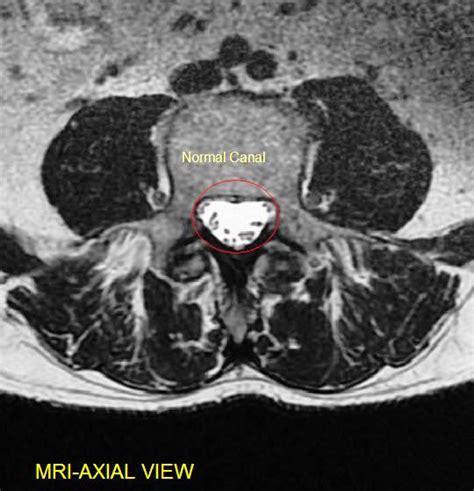 Il: Directions Sciatica mri