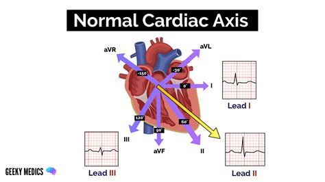 What is Cardiac Axis? | ECG Interpretation | Geeky Medics