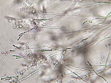 Fun With Microbiology (What's Buggin' You?): Trichosporon species