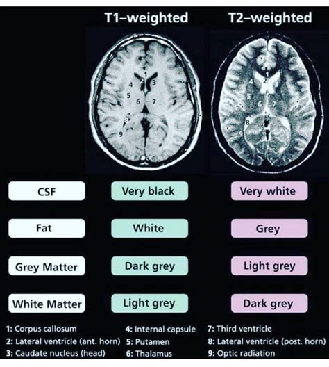 T1 weighted vs T2 weighted - MEDizzy