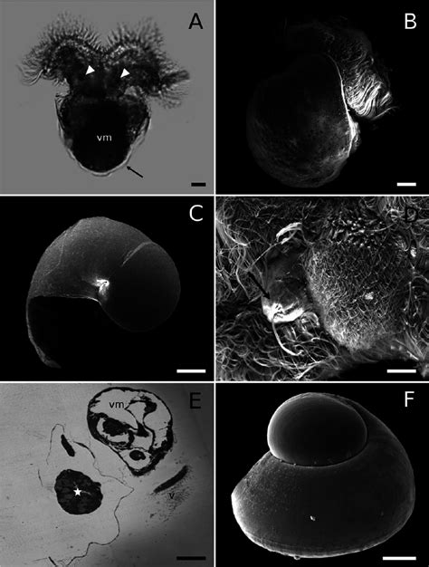 Early veliger larvae of Strombus pugilis. A. Light micrograph of newly ...