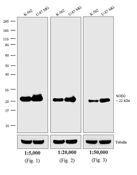 Goat anti-Mouse IgG, IgM (H+L), AP (31328)