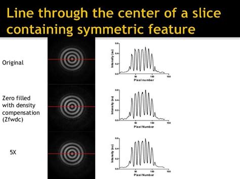 Introduction to compressed sensing MRI