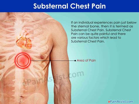 Heart Where Is It Located In The Chest | MedicineBTG.com