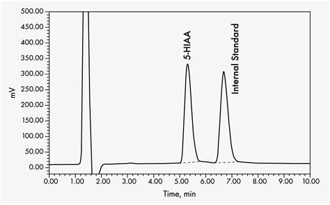 5-HIAA in Urine - HPLC