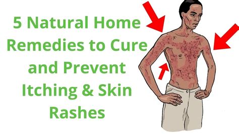 Itchy Skin Rash Pictures Causes Symptoms Treatment