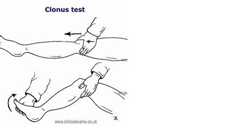 easyhumanatomy: Clonus test : learn procedure with video