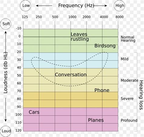 The Benefits Of Knowing The Different Frequencies Tested In A Hearing ...