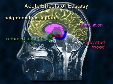 What Mixing Drugs Does to Your Body and Brain - ATTN: