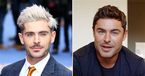 Did Zac Efron Get A Plastic Surgery For His Jaw Before After Look ...