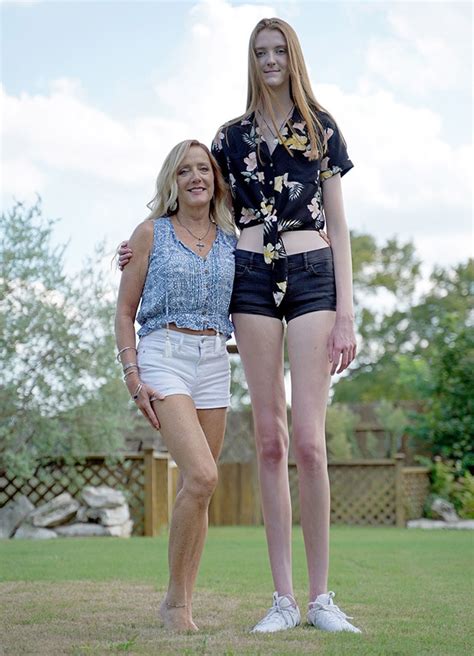 17-Year-Old Aspiring Model Breaks Record For Longest Legs In The World