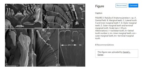 Phylum: Mollusca & their radula | Cephalopod Radula under the SEM