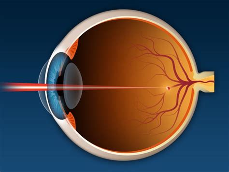 FDA Approved for Macular Degeneration Treatment