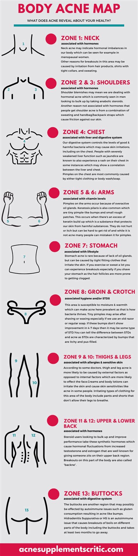 Body Acne Map- What Does It Reveal About Your Health? [INFOGRAPHIC ...