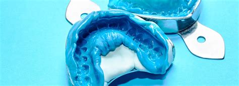 3 Dental Impression Materials and What You Can Expect from Them