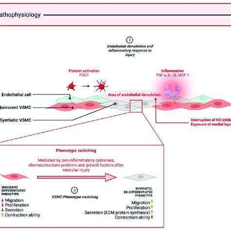 Key pathophysiological processes of in-stent restenosis. (1) Mechanical ...