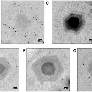 Electron microscopy imaging of the Pithovirus replication cycle in A ...