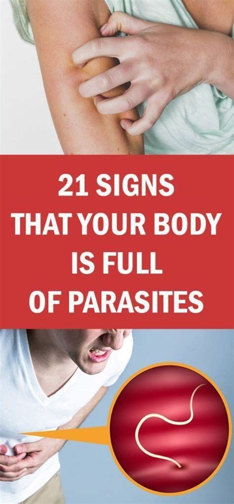 21 Signs That Your Body is Full of Parasites!!!! | Body, Parasite, How ...