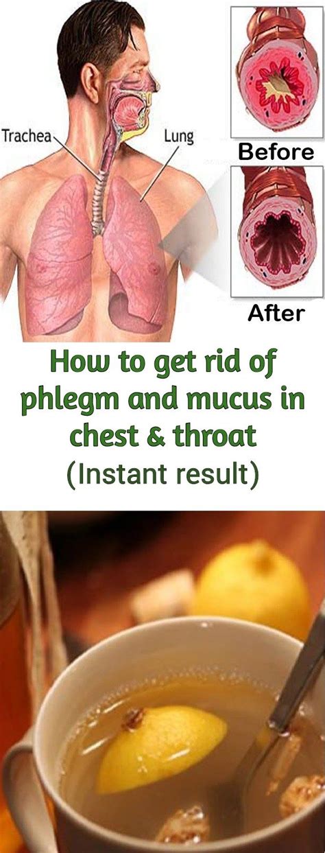 Home Remedies For Phlegm In Throat