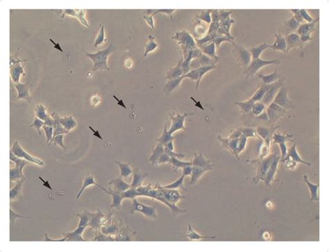 Mycoplasma Contamination Cell Culture