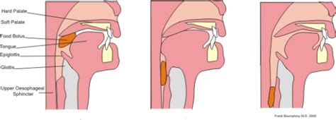 Difference Between Bolus and Chyme | Compare the Difference Between ...