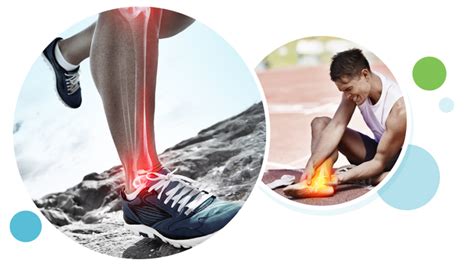 Ankle Instability and Rehab Treatment | Northstate Foot and Ankle