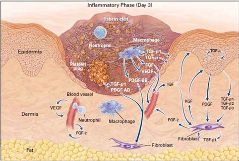 Figure 2 from Mechanisms of delayed wound healing in various models of ...