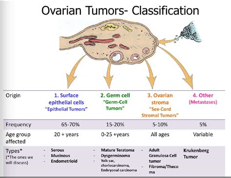 Ovarian Cancer – Exploring Biology