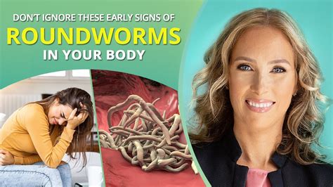 Don’t Ignore These Early Signs of Roundworms in Your Body | Dr. J9 Live ...