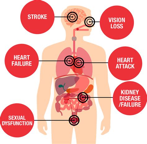 Health Threats from High Blood Pressure | American Heart Association