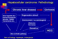 Hepatic Carcinoma Symptoms Of Liver Cancer | MedicineBTG.com