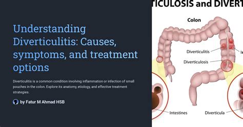 Understanding Diverticulitis: Causes, symptoms, and treatment options