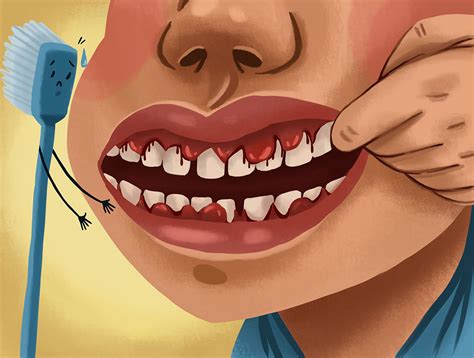 The Causes of Gum Pain - Waterford Periodontics & Implant Dentistry