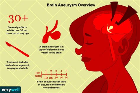 Brain Aneurysms: Symptoms, Causes, Prognosis, and More