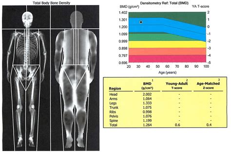 My DEXA Scan for Body Composition - BJJ Caveman