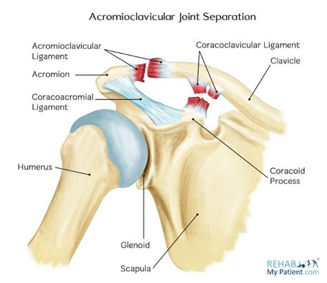 Articles | Rehab My Patient