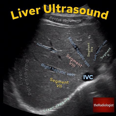 Liver anatomy and protocol – Artofit