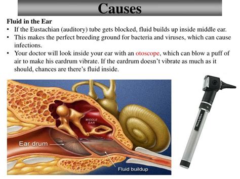 Best Treatment For Fluid Behind Ears at Helen Brown blog