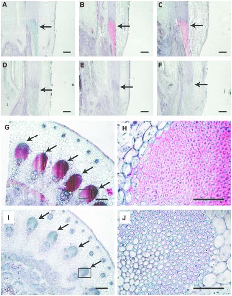 Changes in tissue structure in nodes at three different stages. Nodes ...