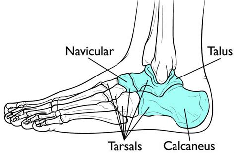 Tarsal coalition causes, symptoms, diagnosis & treatment