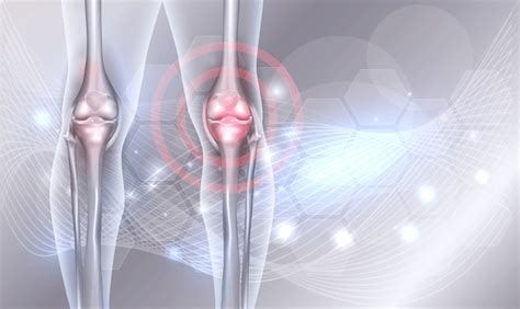 Recovery following a Stem Cell Procedure for Arthritis - Stem Cell ...